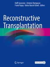 Reconstructive Transplantation