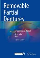 Removable Partial Dentures