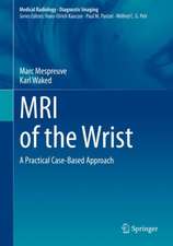 MRI of the Wrist: A Practical Case-Based Approach