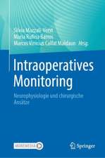 Intraoperatives Monitoring