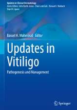 Updates in Vitiligo