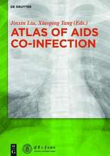 Atlas of AIDS Co-infection