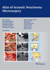 Atlas of Acoustic Neurinoma Microsurgery