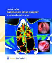 Endoscopic Sinus Surgery: A Comprehensive Atlas