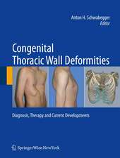 Congenital Thoracic Wall Deformities: Diagnosis, Therapy and Current Developments