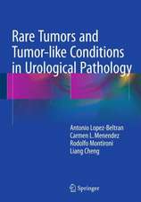 Rare Tumors and Tumor-like Conditions in Urological Pathology