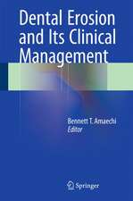 Dental Erosion and Its Clinical Management