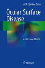 Ocular Surface Disease