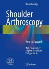 Shoulder Arthroscopy: How to Succeed!