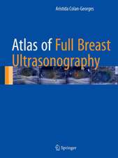 Atlas of Full Breast Ultrasonography