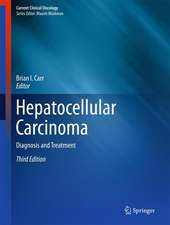 Hepatocellular Carcinoma