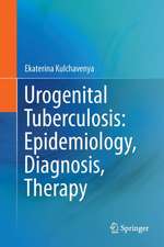 Urogenital Tuberculosis: Epidemiology, Diagnosis, Therapy