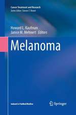 Melanoma