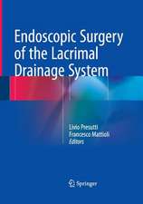 Endoscopic Surgery of the Lacrimal Drainage System