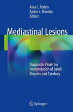 Mediastinal Lesions: Diagnostic Pearls for Interpretation of Small Biopsies and Cytology