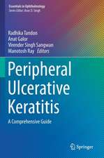 Peripheral Ulcerative Keratitis