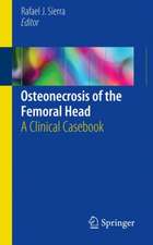 Osteonecrosis of the Femoral Head: A Clinical Casebook