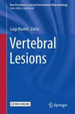 Vertebral Lesions