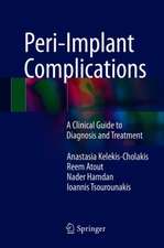 Peri-Implant Complications: A Clinical Guide to Diagnosis and Treatment