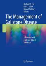 The Management of Gallstone Disease: A Practical and Evidence-Based Approach