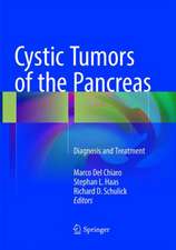 Cystic Tumors of the Pancreas: Diagnosis and Treatment