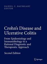 Crohn's Disease and Ulcerative Colitis: From Epidemiology and Immunobiology to a Rational Diagnostic and Therapeutic Approach