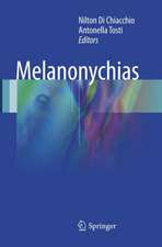 Melanonychias