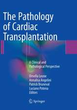 The Pathology of Cardiac Transplantation: A clinical and pathological perspective