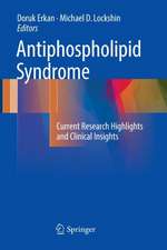 Antiphospholipid Syndrome: Current Research Highlights and Clinical Insights