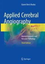 Applied Cerebral Angiography: Normal Anatomy and Vascular Pathology