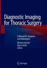 Diagnostic Imaging for Thoracic Surgery: A Manual for Surgeons and Radiologists