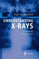 Understanding X-Rays: A Synopsis of Radiology