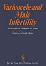 Varicocele and Male Infertility: Recent Advances in Diagnosis and Therapy