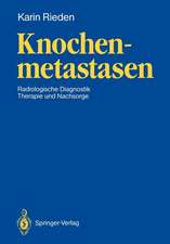 Knochenmetastasen: Radiologische Diagnostik, Therapie und Nachsorge