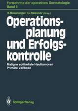 Operationsplanung und Erfolgskontrolle