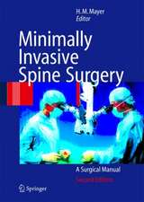 Minimally Invasive Spine Surgery: A Surgical Manual