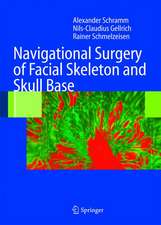 Navigational Surgery of the Facial Skeleton