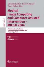 Medical Image Computing and Computer-Assisted Intervention -- MICCAI 2004: 7th International Conference Saint-Malo, France, September 26-29, 2004, Proceedings, Part II