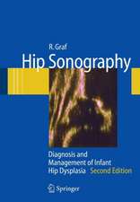 Hip Sonography: Diagnosis and Management of Infant Hip Dysplasia