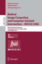 Medical Image Computing and Computer-Assisted Intervention – MICCAI 2006: 9th International Conference, Copenhagen, Denmark, October 1-6, 2006, Proceedings, Part I