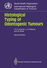 Histological Typing of Odontogenic Tumours