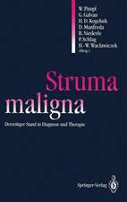 Struma maligna: Derzeitiger Stand in Diagnose und Therapie