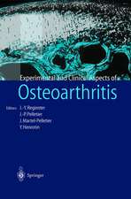 Osteoarthritis: Clinical and Experimental Aspects