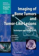 Imaging of Bone Tumors and Tumor-Like Lesions: Techniques and Applications