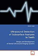 Ultrasound Detection of Subsurface Features in Teeth