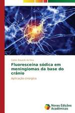 Fluoresceina Sodica Em Meningiomas Da Base Do Cranio: Educ