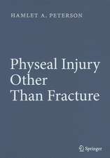 Physeal Injury Other Than Fracture