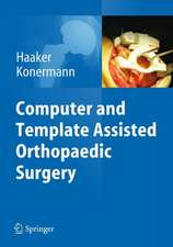 Computer and Template Assisted Orthopedic Surgery