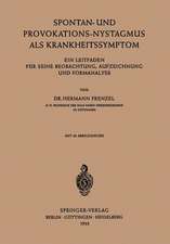 Spontan-und Provokations-Nystagmus als Krankheitssymptom: Ein Leitfaden für Seine Beobachtung, Aufzeichnung und Formanalyse