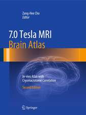 7.0 Tesla MRI Brain Atlas: In-vivo Atlas with Cryomacrotome Correlation